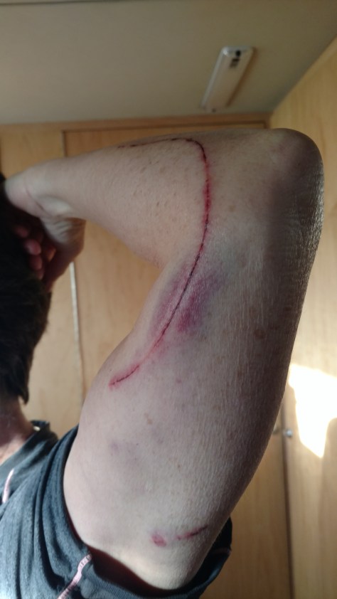 IMG_20160721_070648779